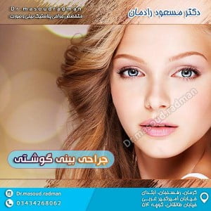 جراحی بینی گوشتی در رفسنجان - دکتر رادمان