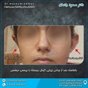 جراحی-گوش-2