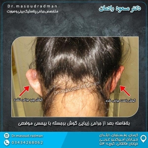 جراحی-گوش1