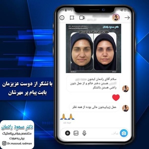 جراحی-بینی-در-کرمان-54