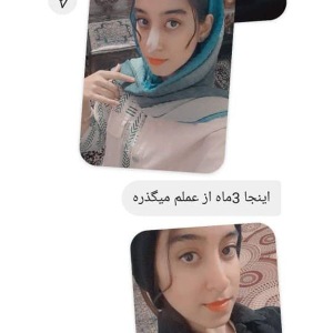 جراحی-بینی-469