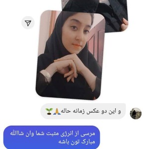 جراحی-بینی-470