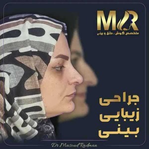جراحی-بینی-472