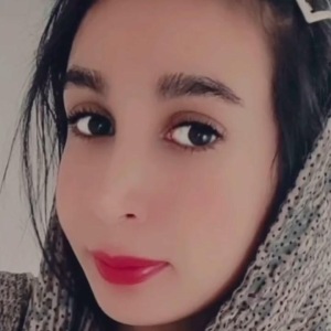 rhinoplasty-767