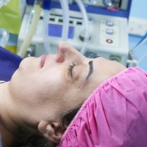 rhinoplasty-786