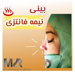 rhinoplasty-787