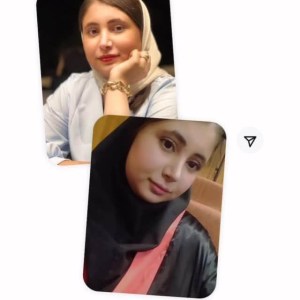 rhinoplasty-790