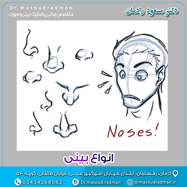 انواع بینی