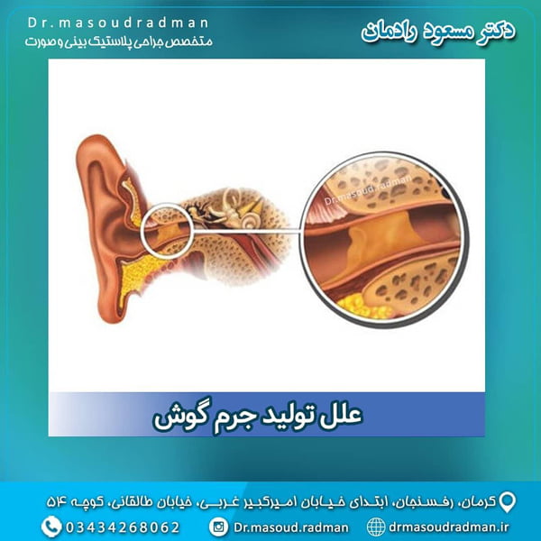 جرم گوش