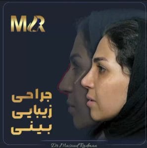 بهترین جراح بینی کرمان https://drmasoudradman.ir/