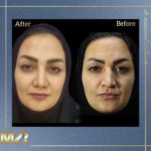 جراحی بینی https://drmasoudradman.ir/