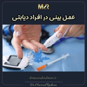 عمل بینی در افراد دیابتی https://drmasoudradman.ir/