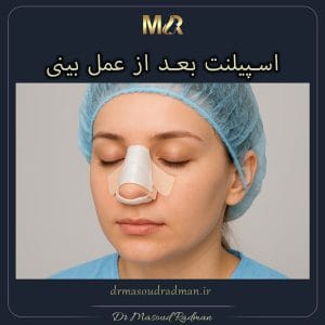 اسپیلنت بعد از عمل بینی