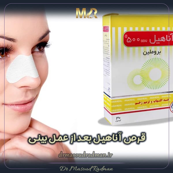 قرص آناهیل بعد از عمل بینی