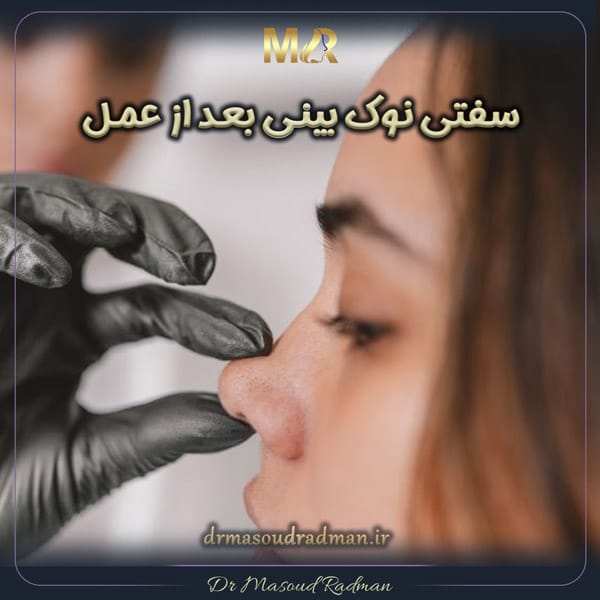 سفتی نوک بینی بعد از عمل