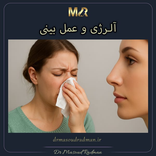 آلرژی و عمل بینی
