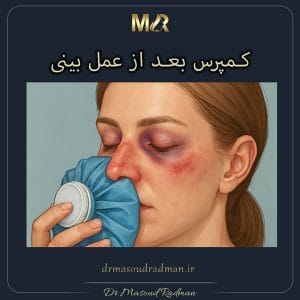 کمپرس سرد و گرم بعد از جراحی بینی