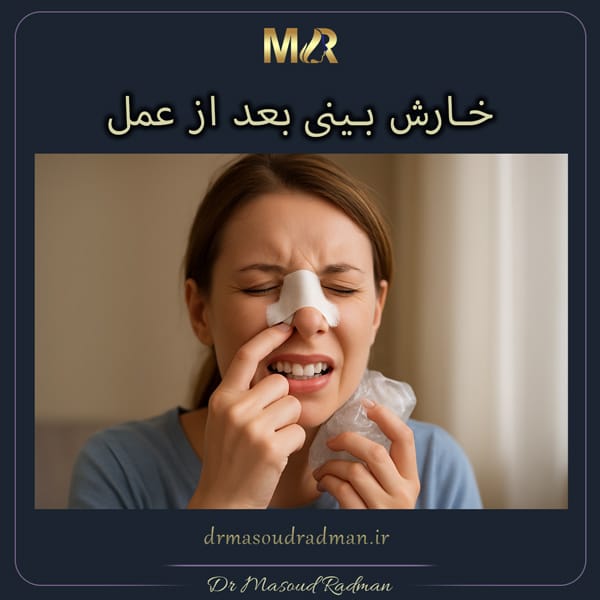 خارش بینی بعد از عمل _ دکتر مسعود رادمان