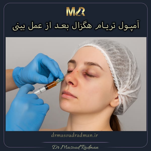 آمپول تریام هگزال بعد از عمل بینی