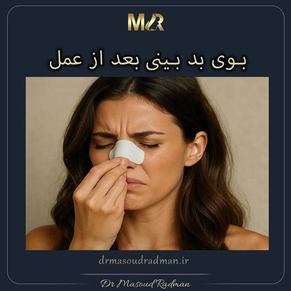 بوی بد بینی بعد از عمل: علت و درمان