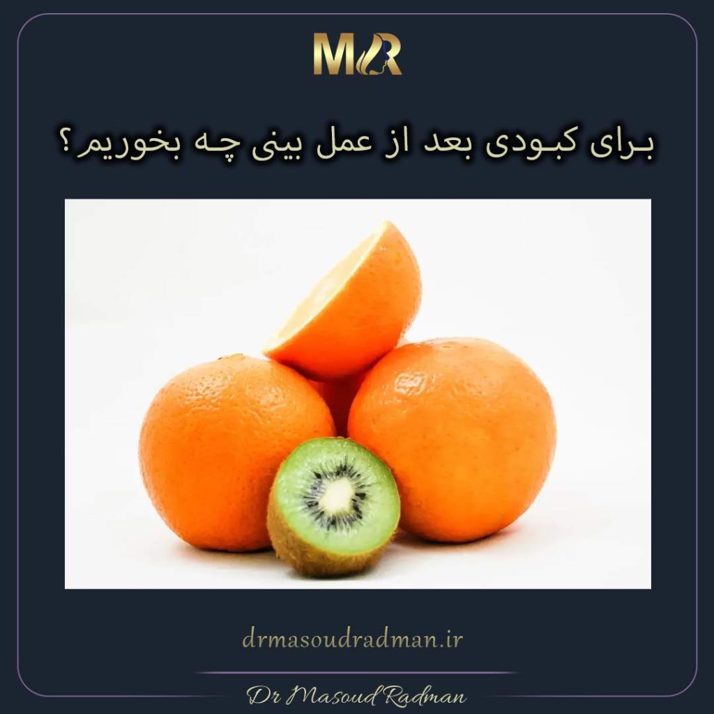 کبودی بعد از عمل بینی