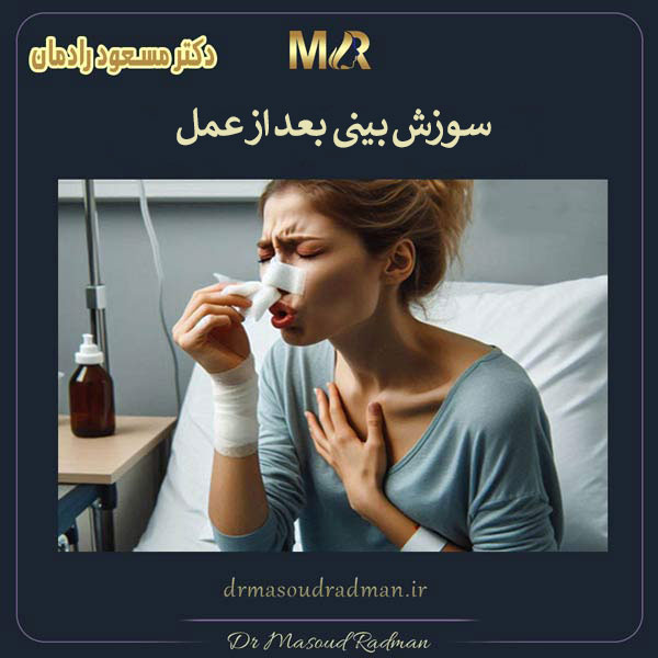 سوزش بینی بعد از عمل _ دکتر مسعود رادمان