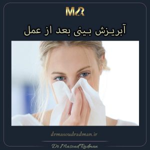آبریزش بینی بعد از عمل