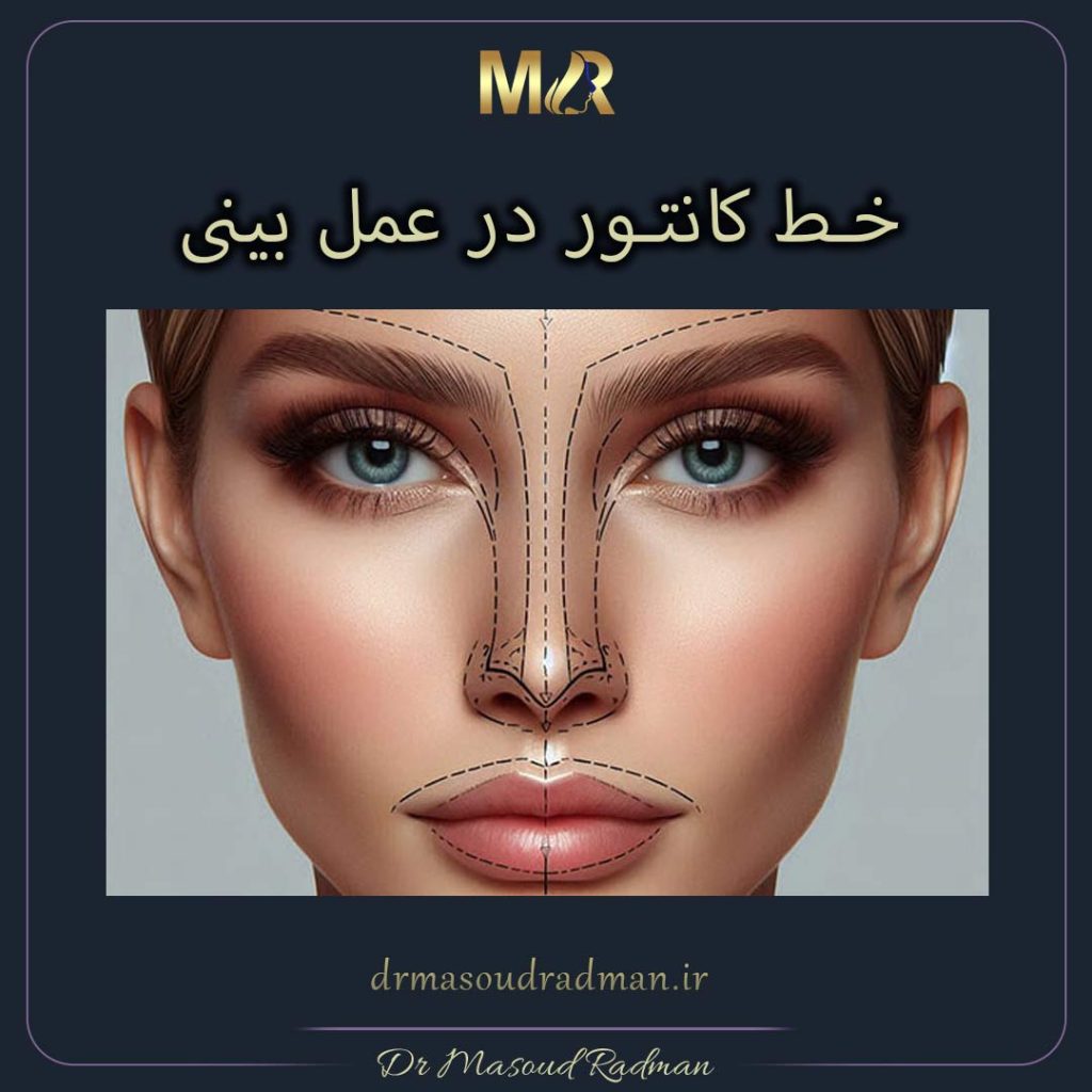 خط کانتور در عمل بینی