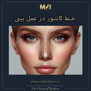 خط کانتور در عمل بینی
