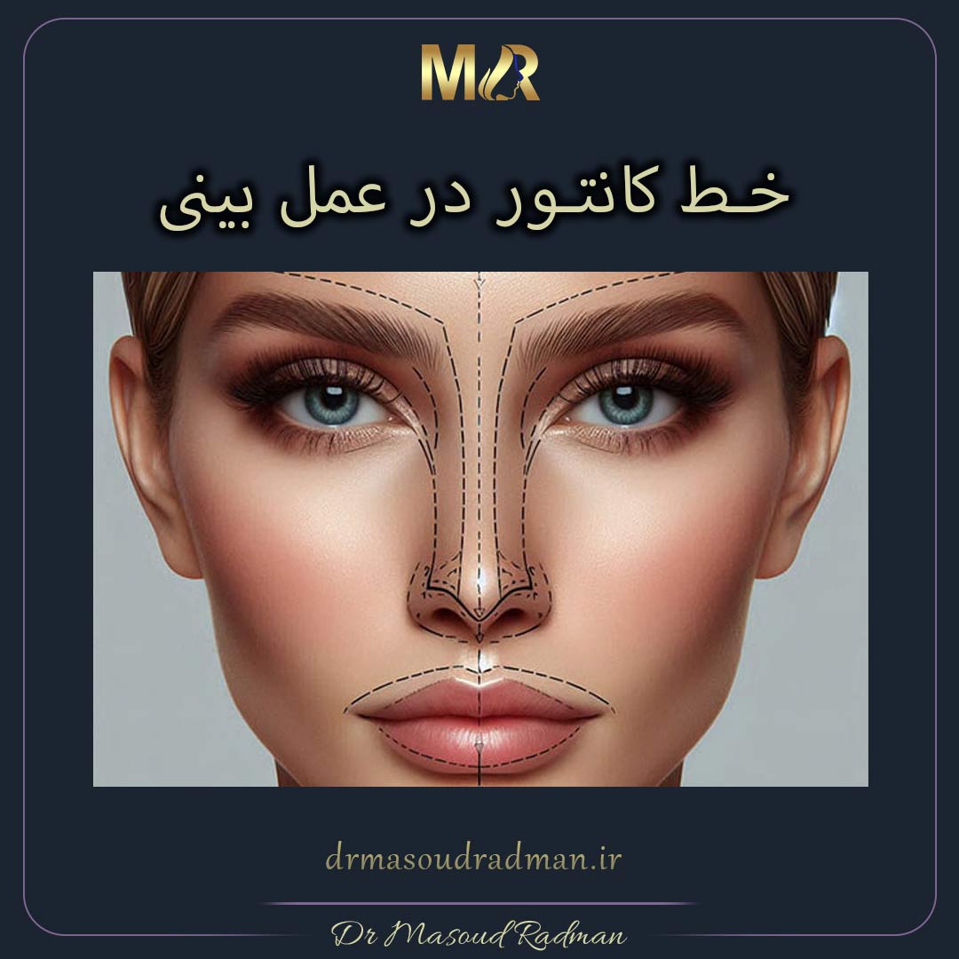 خط کانتور در عمل بینی